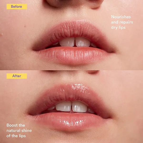 The Lip Therapist Balm